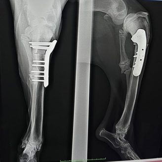 痛みを伴う大きな手術にも耐えました