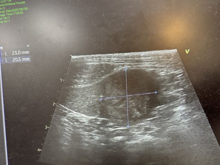 保護犬 小梅ちゃん(検査画像)